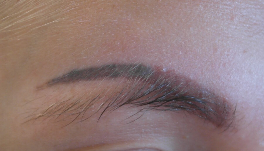 Permanent MakeupEyebrow Laser Tattoo Removal Guidelines  Fresh Skin Canvas